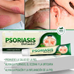 🍃CREMA PSORIASIS Elimina Hongos, Picazón y Psoriasis Rápido y Recupera tu Piel Sana+ L800- envio gratis