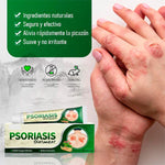 🍃CREMA PSORIASIS Elimina Hongos, Picazón y Psoriasis Rápido y Recupera tu Piel Sana+ L800- envio gratis