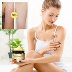 🐝 BEE VENOM - Tratamiento avanzado para  marcas y verrugas de la piel- 749.99+ Envío Gratis 🚚