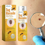 ✨ TAG RECEDE™ Spray tópico - Olvídate de las verrugas 2X1 -L900+envio gratis