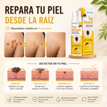 ✨ TAG RECEDE™ Spray tópico - Olvídate de las verrugas 2X1 -L900+envio gratis