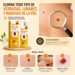 ✨ TAG RECEDE™ Spray tópico - Olvídate de las verrugas 2X1 -L900+envio gratis
