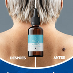 VerruCler™ 2x1 L800 + Dile adios a las verrugas