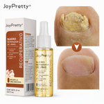 🍃JoyPretty™ el cuidado intensivo de uñas -(manos y pies)  -L700 + envio gratis