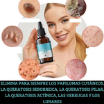 VerruCler™ 2x1 L800 + Dile adios a las verrugas